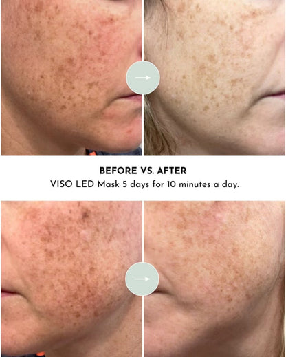 VISO red light mask